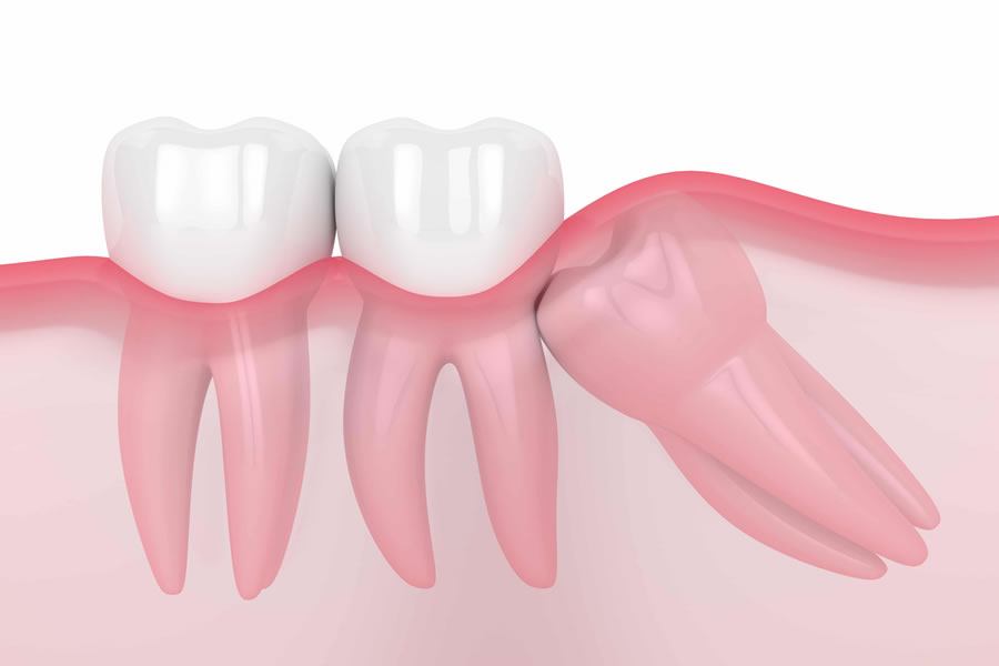 chirurgie dentara pitesti